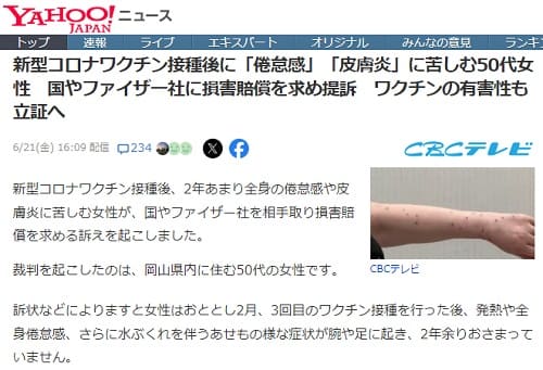 2024�N6��21�� Yahoo�j���[�X�ւ̃����N�摜�ł��B